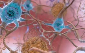 Scientist explores the involvement of tau in Alzheimer's disease
