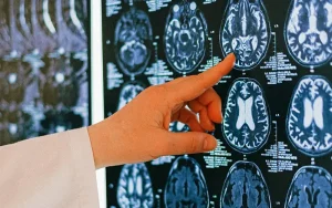 Head injuries may increase the risk of brain cancer