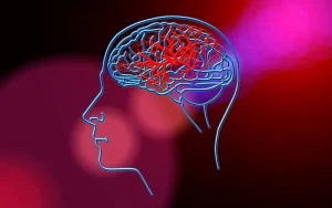 سیستم مبتنی بر هوش مصنوعی برای هدایت تصمیمات درمانی سکته مغزی 